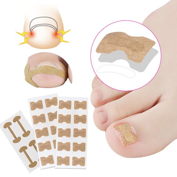 1set ingrown toenail corrector sticker paronychia treatment pedicure foot orthodontic toe thumb nail care patches
1set ingrown toenail corrector sticker paronychia treatment pedicure foot orthodontic toe thumb nail care patches