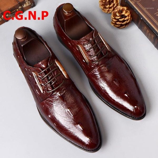 c.g.n.p real cow leather shoes for men crocodile pattern pointed toe derby mens shoes lace-up formal men dress1, Black
c.g.n.p real cow leather shoes for men crocodile pattern pointed toe derby mens shoes lace-up formal men dress1, Black