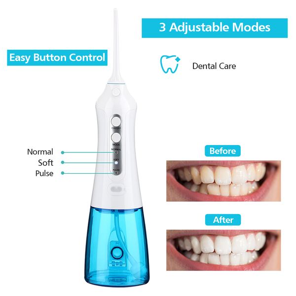 oral flosser irrigator usb rechargeable cordless dental water flosser dental care teeth cleaner cleaning teeth hygiene tool perfections
oral flosser irrigator usb rechargeable cordless dental water flosser dental care teeth cleaner cleaning teeth hygiene tool perfections