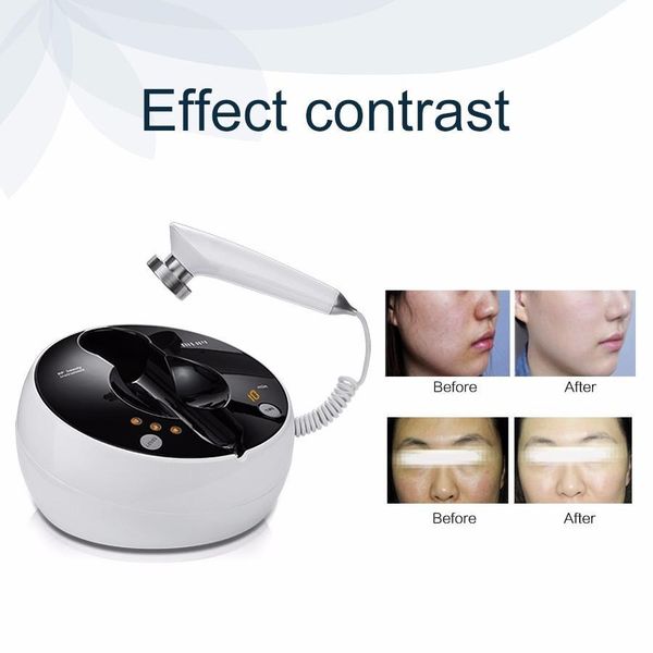 radio frequency facial and body skin tightening machine-professional home rf lifting skin care anti aging device
radio frequency facial and body skin tightening machine-professional home rf lifting skin care anti aging device