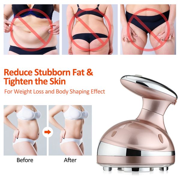rfcavitationultrasonicslimmingmassagerledfatburneranticellulitelipodeviceskintighteningweightlossbeautymachine raben
rfcavitationultrasonicslimmingmassagerledfatburneranticellulitelipodeviceskintighteningweightlossbeautymachine raben
