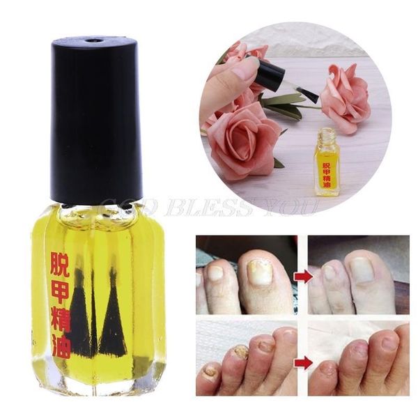 painless nail removal nail treatment repair nails care fungus essential oil 5ml drop shipping painl jlllpr
painless nail removal nail treatment repair nails care fungus essential oil 5ml drop shipping painl jlllpr