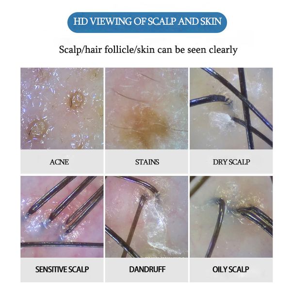 wirelessappwifiskinhairfolliclesscalpdetector200xdigitalskinanalyzerhairsalonskinhairtestermicroscope2022new raben
wirelessappwifiskinhairfolliclesscalpdetector200xdigitalskinanalyzerhairsalonskinhairtestermicroscope2022new raben