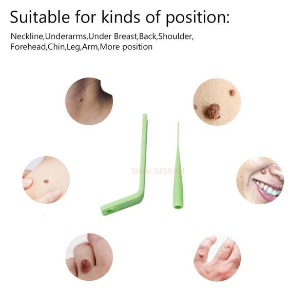 micro band skin tags remover remove warts skin care wart treatment face skin tag removal tool acne remover with cleansing swabs
micro band skin tags remover remove warts skin care wart treatment face skin tag removal tool acne remover with cleansing swabs