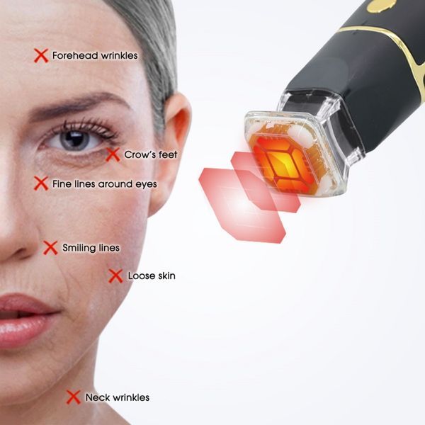 portable thermagic machine face lift thermagic radio frequency facial skin tightening machine
portable thermagic machine face lift thermagic radio frequency facial skin tightening machine