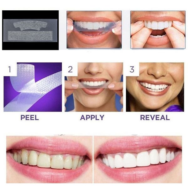 2pcs pack professional white gel teeth whitening strip tooth whitening strip tooth whiter whitestrips stripes bleaching tools bbyjbl
2pcs pack professional white gel teeth whitening strip tooth whitening strip tooth whiter whitestrips stripes bleaching tools bbyjbl