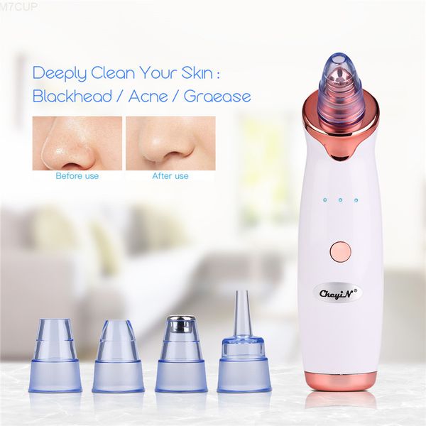 micro-dermabrasion comedy printer vacuum suction face powder acne comedo extractor facial pores cleaner skin care tool 38
micro-dermabrasion comedy printer vacuum suction face powder acne comedo extractor facial pores cleaner skin care tool 38