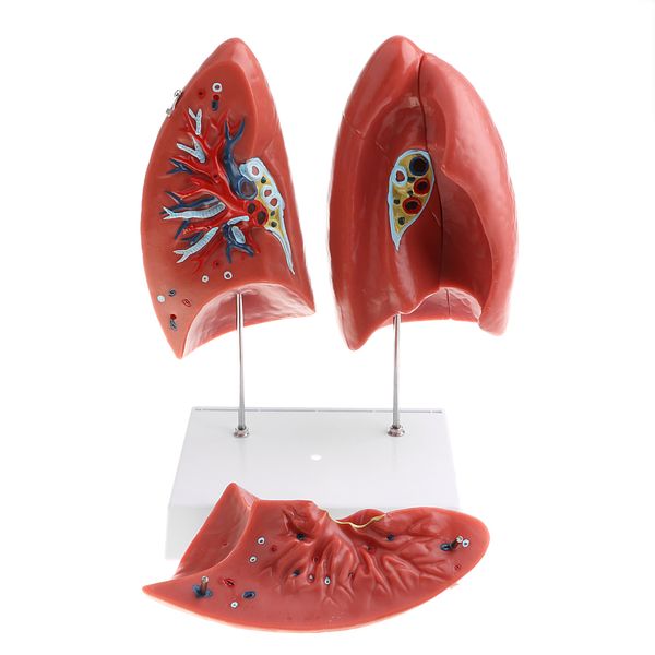 1:1 lifesize human lung structure removable 4 parts lab demonstration model school teaching display
1:1 lifesize human lung structure removable 4 parts lab demonstration model school teaching display