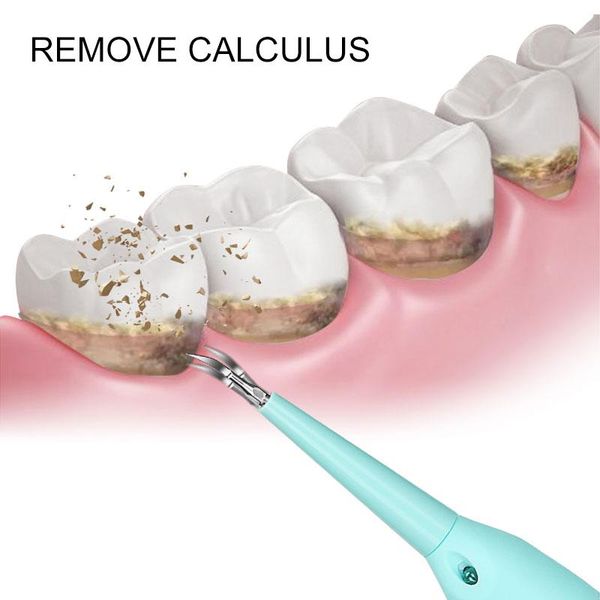 portable electric sonic dental scaler tooth calculus removal teeth stains tartar usb charge dentist whiten teeth health hygiene
portable electric sonic dental scaler tooth calculus removal teeth stains tartar usb charge dentist whiten teeth health hygiene