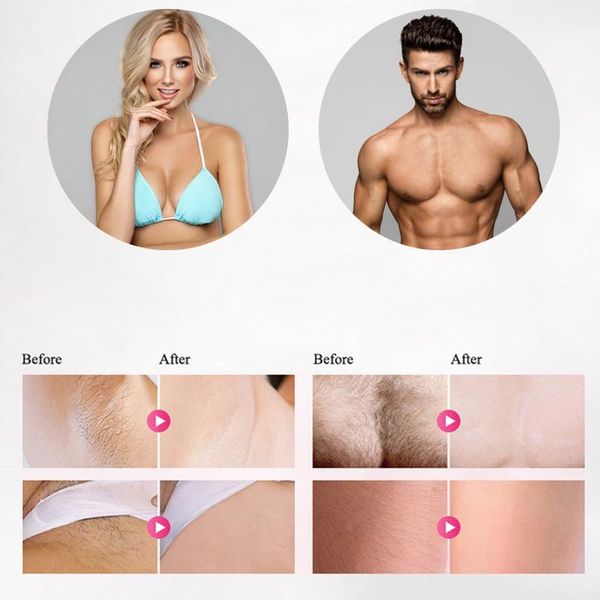 flash professional permanent laser hair removal electric female painless threading hair removal instrumentnis
flash professional permanent laser hair removal electric female painless threading hair removal instrumentnis