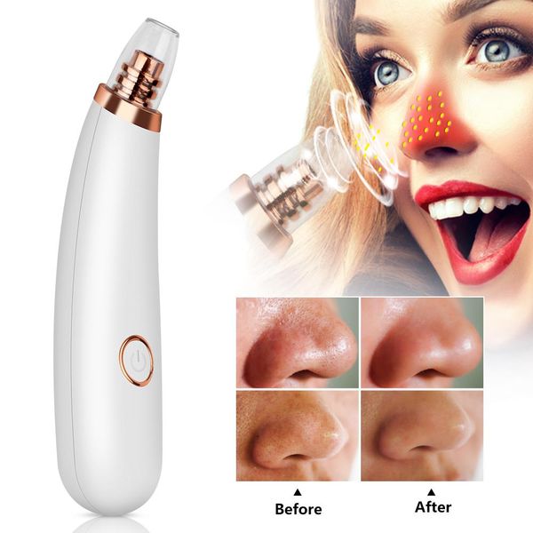 black point skin extractor пятна черноголовых чистого инструмента noir угорь электрический pore машина по уходу за лицом вакуумный sqcxyt tr
black point skin extractor пятна черноголовых чистого инструмента noir угорь электрический pore машина по уходу за лицом вакуумный sqcxyt tr