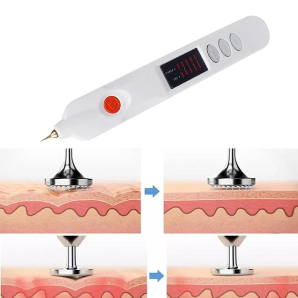 multi-functional freckle mole remover plasma pen wart spot tattoo removal wrinkles removal skin firming ionic skin care machine
multi-functional freckle mole remover plasma pen wart spot tattoo removal wrinkles removal skin firming ionic skin care machine