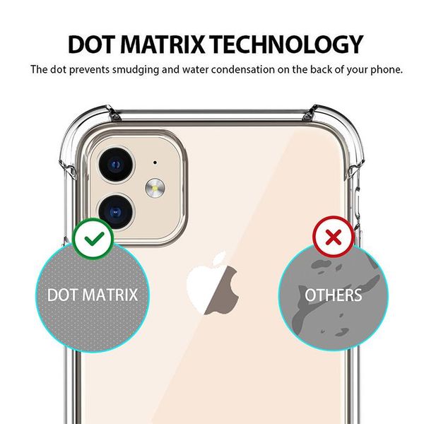 прозрачный абонентный силиконовый чехол для телефона для iphone 12 11 pro x xs max mini case для iphone 7 8 6 6s plus sqcvwh shume2010
прозрачный абонентный силиконовый чехол для телефона для iphone 12 11 pro x xs max mini case для iphone 7 8 6 6s plus sqcvwh shume2010