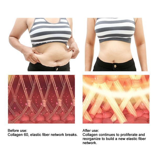 fastshipping6in1slimmingsystemultrasoniccavitation40krffatremovalspauselipolasermachinebeautydevice raben
fastshipping6in1slimmingsystemultrasoniccavitation40krffatremovalspauselipolasermachinebeautydevice raben