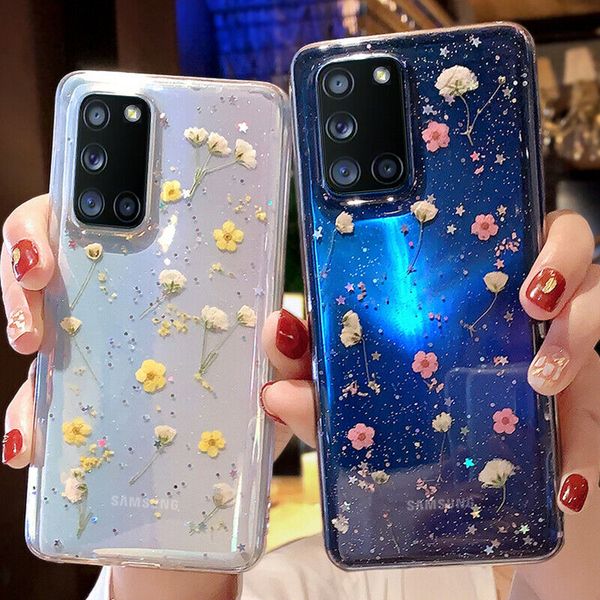 2021 new for samsung galaxy a21s a51 a71 s20 pressed real flower glitter clear case cover for samsung series epoxy flower phone case
2021 new for samsung galaxy a21s a51 a71 s20 pressed real flower glitter clear case cover for samsung series epoxy flower phone case