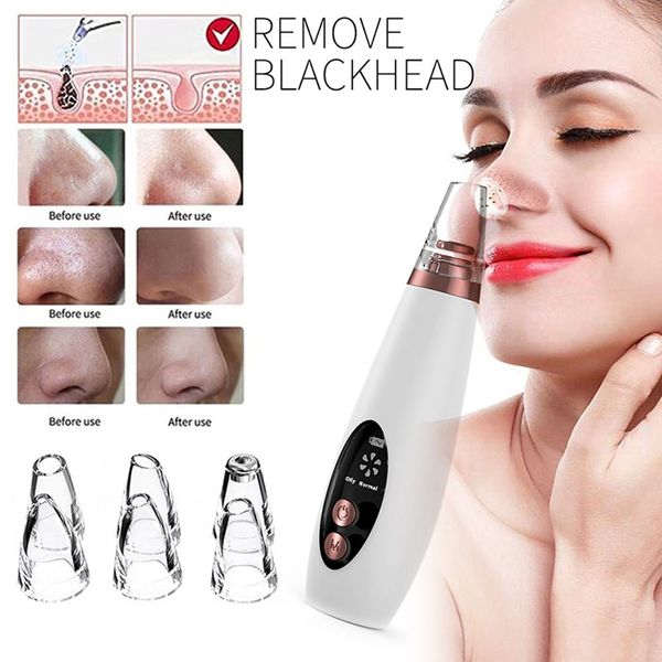 electric blackhead remover extractor facial acne pore cleaner vacuum sunction skin care tools deep cleaning
electric blackhead remover extractor facial acne pore cleaner vacuum sunction skin care tools deep cleaning