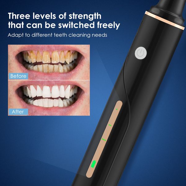visual ultrasonic dental scaler set electric tooth cleaning machine tartar calculus removal eliminator with led light hd cameraperfections
visual ultrasonic dental scaler set electric tooth cleaning machine tartar calculus removal eliminator with led light hd cameraperfections