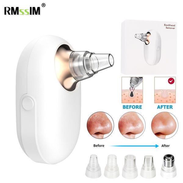 electric blackhead suction instrument blackhead removal artifact household pore cleaner beauty instrument
electric blackhead suction instrument blackhead removal artifact household pore cleaner beauty instrument