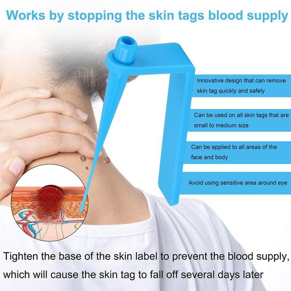 medical skin tag kill skin mole wart remover micro band skin tag removal kit with cleansing swabs mole wart face care tool
medical skin tag kill skin mole wart remover micro band skin tag removal kit with cleansing swabs mole wart face care tool