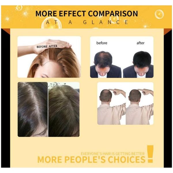 natural extract liquid hair shampoo conditioner hair loss essential oils for scalp nourishing leave in hair growth treatments sqcwff
natural extract liquid hair shampoo conditioner hair loss essential oils for scalp nourishing leave in hair growth treatments sqcwff
