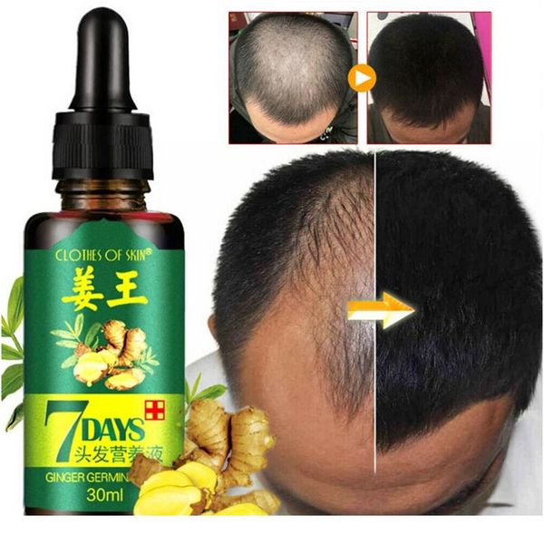 ginger hair growth essence 7 days germinal hair growth serum essence oil hair loss treatment growth for m wmtsbl