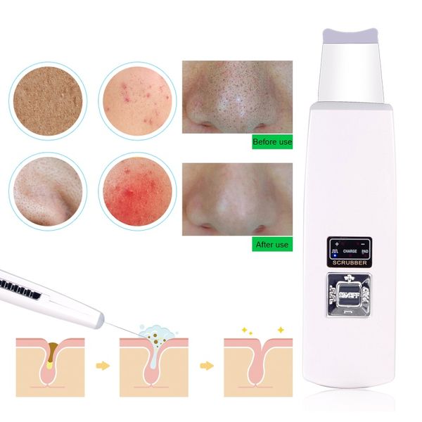 ultrasonic skin scrubber deep face cleaning machine remove dirt blackhead reduce wrinkles and spots facial whitening lifting f wmthey
ultrasonic skin scrubber deep face cleaning machine remove dirt blackhead reduce wrinkles and spots facial whitening lifting f wmthey