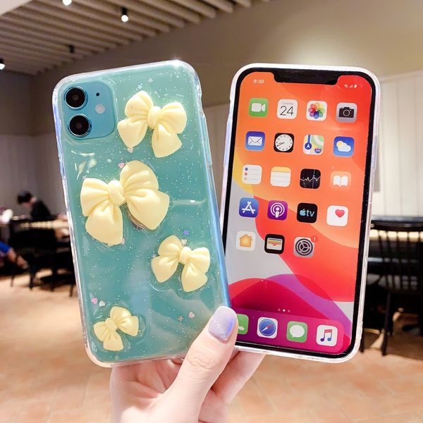 epoxy three-dimensional bow for apple 11 mobile phone case iphone12/xr/7/8plusxsmax transparent case
epoxy three-dimensional bow for apple 11 mobile phone case iphone12/xr/7/8plusxsmax transparent case