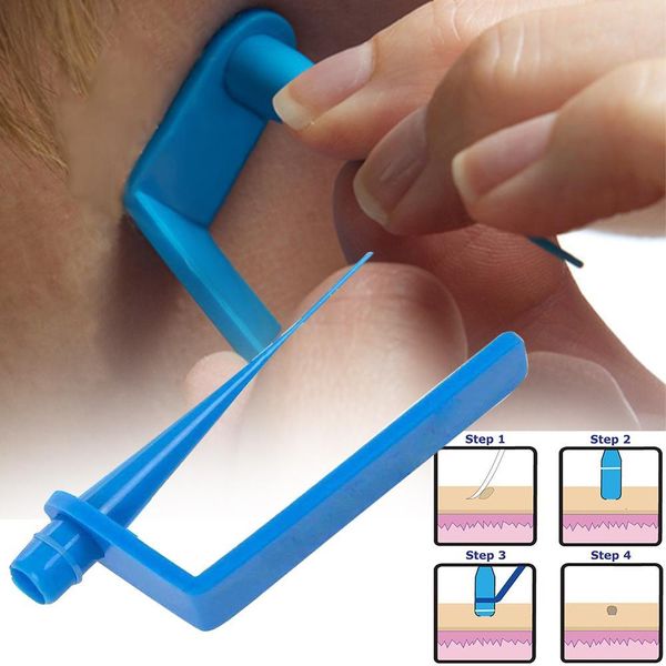 medical skin tag removal kit micro band skin tags warts remover patch with cleansing swabs wart treatment face skin care tool
medical skin tag removal kit micro band skin tags warts remover patch with cleansing swabs wart treatment face skin care tool