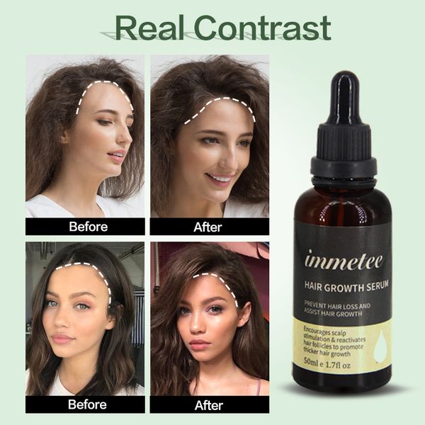powerful hair growth serum prevent hair loss essential oil longer thicker prevent baldness products hair grow growth 3pcssc
powerful hair growth serum prevent hair loss essential oil longer thicker prevent baldness products hair grow growth 3pcssc