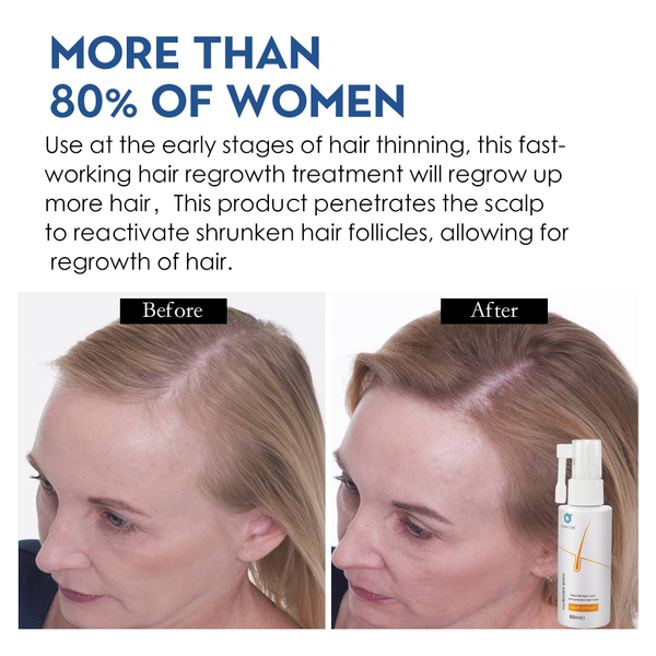 haircube 3pcs fast hair growth essence anti hair loss treatment hair care products dense thick nourish roots regrowth sprayscouts
haircube 3pcs fast hair growth essence anti hair loss treatment hair care products dense thick nourish roots regrowth sprayscouts