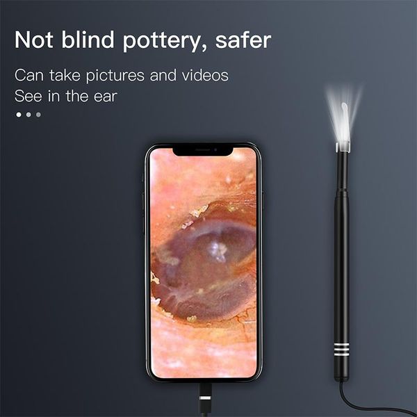cameras an108 three-in-one visual clean ear pick spoon hd vido waterproof otoscope intelligent picking tool
cameras an108 three-in-one visual clean ear pick spoon hd vido waterproof otoscope intelligent picking tool