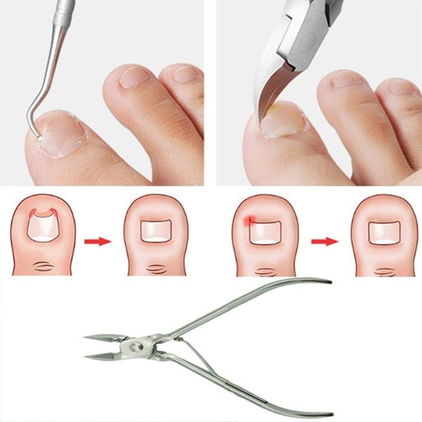 professional ingrown toe nail correction tool pedicure tool foot nail care toe nail hook ingrown tool hand foot file care
professional ingrown toe nail correction tool pedicure tool foot nail care toe nail hook ingrown tool hand foot file care