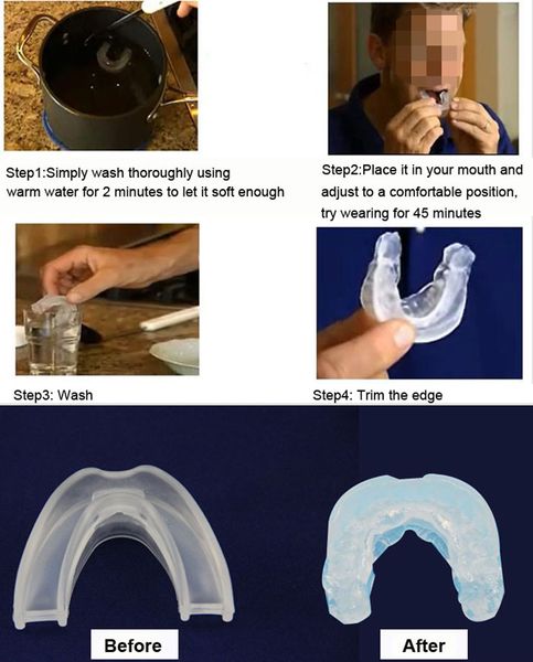 ssnoring anti snore soft silicone mouthpiece apnea guard bruxism tray night sleeping aid sn-hot
ssnoring anti snore soft silicone mouthpiece apnea guard bruxism tray night sleeping aid sn-hot