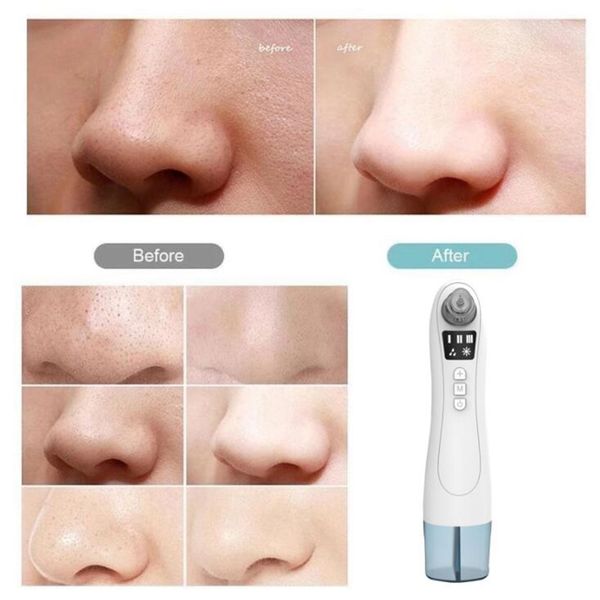blackhead remover vacuum pore cleaner electric nose face deep cleansing skin care machine beauty tool
blackhead remover vacuum pore cleaner electric nose face deep cleansing skin care machine beauty tool