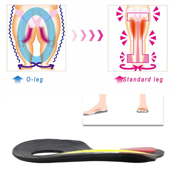 o/x legs correction insoles orthopedic insoles arch support orthoses pad massaging shoe insoles foot health sn-ho
o/x legs correction insoles orthopedic insoles arch support orthoses pad massaging shoe insoles foot health sn-ho