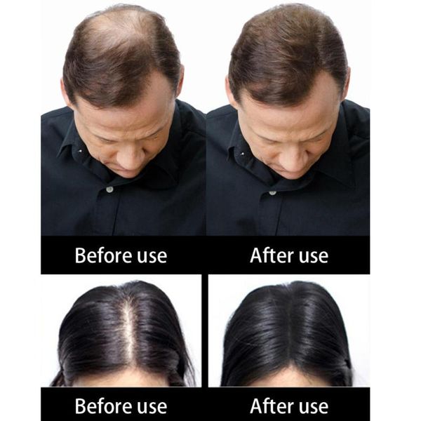 salon keratin hair building fibers hair loss treatment care conceal thinning hair fiber care growth products dropshipping
salon keratin hair building fibers hair loss treatment care conceal thinning hair fiber care growth products dropshipping