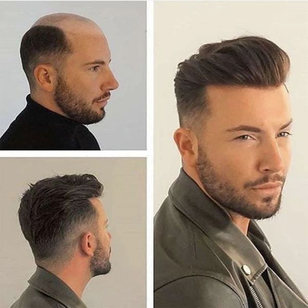 men's wig transparent pu men toupee men's hair pieces unit hairs replacement system black color 8x10inch wigs for mens
men's wig transparent pu men toupee men's hair pieces unit hairs replacement system black color 8x10inch wigs for mens