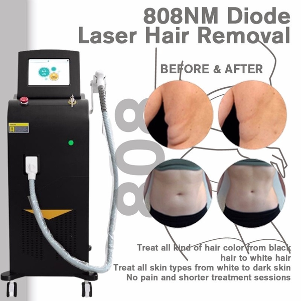 2022 lattest 808nm diode laser hair removal local area fast removal 808 device for sale, Black
2022 lattest 808nm diode laser hair removal local area fast removal 808 device for sale, Black