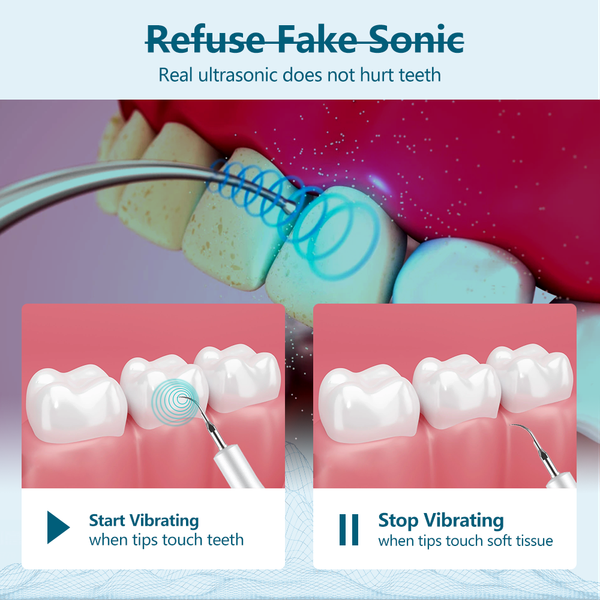 teeth stain remover tartar ultrasonic dental scaler cleansing oral teeth whitening clean home use teeth stains scaling tool perf
teeth stain remover tartar ultrasonic dental scaler cleansing oral teeth whitening clean home use teeth stains scaling tool perf