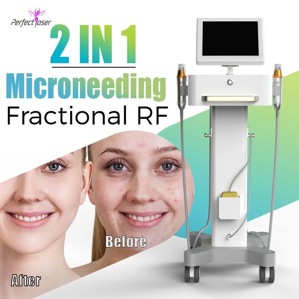 2021 microneedle machine radio frequency 5mhz face lifting tightening thermalift fractional rf skin rejuvenation device for scars removal
2021 microneedle machine radio frequency 5mhz face lifting tightening thermalift fractional rf skin rejuvenation device for scars removal