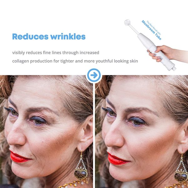 portablehighfrequencyfacialwandhaircareelectrodespotacneremoverskincarefacehairspasalonbeautydevice raben
portablehighfrequencyfacialwandhaircareelectrodespotacneremoverskincarefacehairspasalonbeautydevice raben