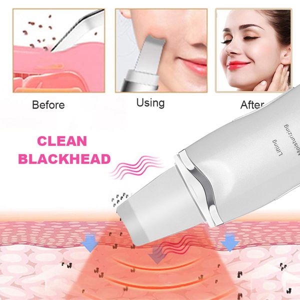 ultrasonic skin scrubber nano facial steamer blackhead remover face steamer facial cleansing peeling machine pore cleaner
ultrasonic skin scrubber nano facial steamer blackhead remover face steamer facial cleansing peeling machine pore cleaner