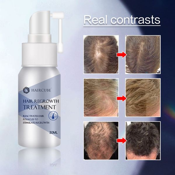 2pcs hair growth spray anti hair loss treatment natural herbal health hair growth longer and thicker care productsscouts
2pcs hair growth spray anti hair loss treatment natural herbal health hair growth longer and thicker care productsscouts