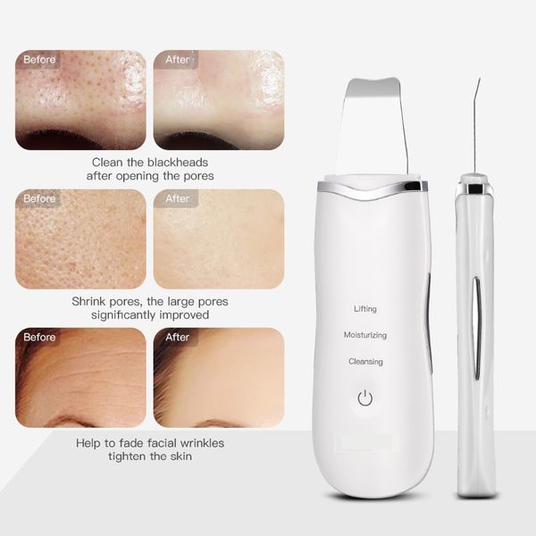ultrasonic skin scrubber deep cleaning face scrubber vibrating facial cleansing skin spatula peeling beauty instrument device
ultrasonic skin scrubber deep cleaning face scrubber vibrating facial cleansing skin spatula peeling beauty instrument device
