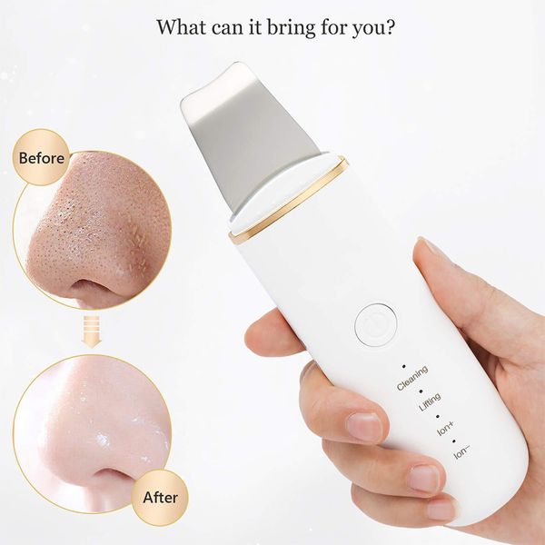 ultrasonic skin scrubber face deep cleansing machine acne blackhead remover peeling shovel facial massager lifting tools
ultrasonic skin scrubber face deep cleansing machine acne blackhead remover peeling shovel facial massager lifting tools
