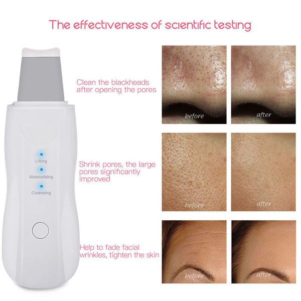 vibrate ultrasonic deep face cleaning machine skin scrubber blackhead acne remover reduce wrinkles facial whitening lifting tool
vibrate ultrasonic deep face cleaning machine skin scrubber blackhead acne remover reduce wrinkles facial whitening lifting tool