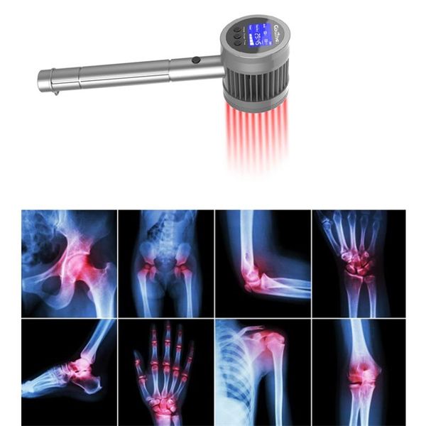electric massagers lllt relief therapeutic self-use and rental treatment equipment pain arthritis,rheumatism home remedies
electric massagers lllt relief therapeutic self-use and rental treatment equipment pain arthritis,rheumatism home remedies