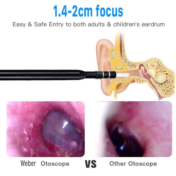 smart ear cleaner camera otoskop ear candles otoscope ear wax removal tool with camera endoscope camera support android pcsc
smart ear cleaner camera otoskop ear candles otoscope ear wax removal tool with camera endoscope camera support android pcsc