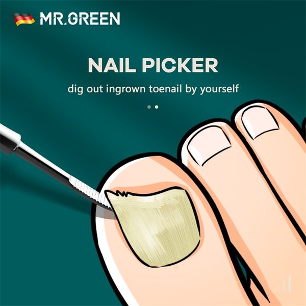 mr.green nails picker treatment pedicures cutter tools kit knipper under cleaner ingrown toenail squeezed dig out underneath 211007
mr.green nails picker treatment pedicures cutter tools kit knipper under cleaner ingrown toenail squeezed dig out underneath 211007