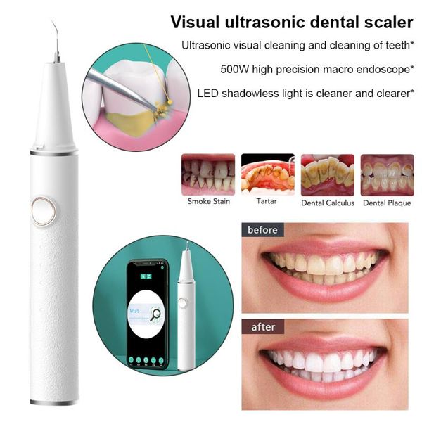 smart electric toothbrush portable dental scaler usb high-precision macro visual for home oral cleaner and beauty instrument
smart electric toothbrush portable dental scaler usb high-precision macro visual for home oral cleaner and beauty instrument